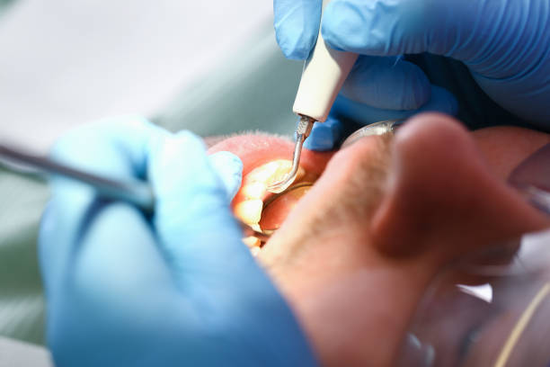 Best Emergency Dentist for Special Needs Patients in Lexington, IL