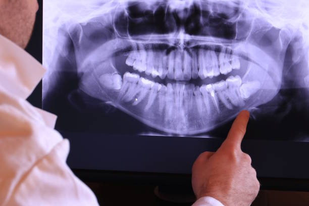 Best Emergency Dentist for Knocked-Out Tooth in Lexington, IL