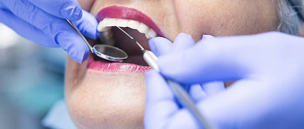 Best Emergency Dental Care for Abscessed Tooth in Lexington, IL