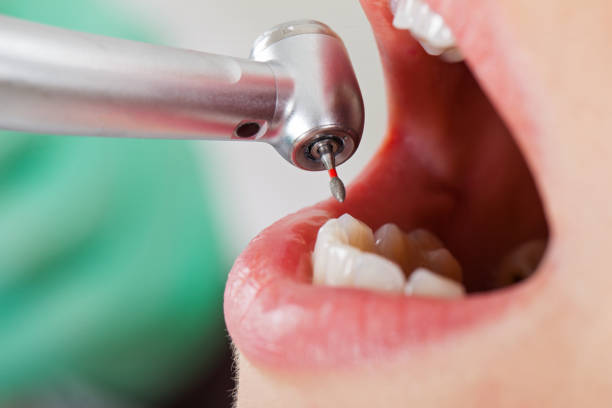 Best Emergency Dental Services for Seniors in Lexington, IL